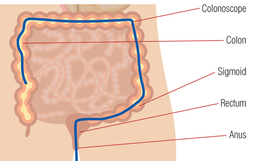 Crohn's disease treating and diagnosing diagram