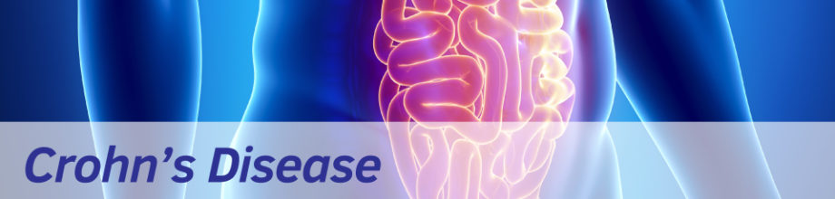 Crohn’s Disease is one of the two conditions known as Inflammatory Bowel Diseases (IBD); with the other being ulcerative colitis