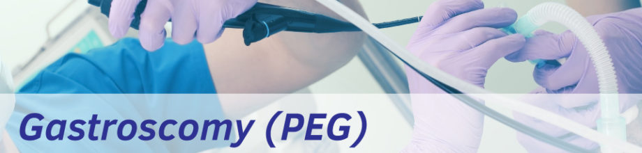 What is a PEG?